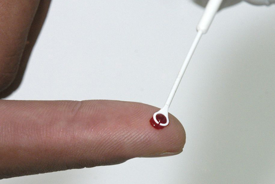 Campanha em alusão ao Dia dos Namorados alerta para prevenção de HIV e outras doenças