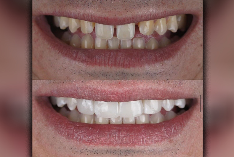 Além da autoestima: saiba como a estética dental favorece a saúde